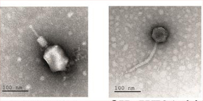 Бактериофаги в лечении бактериального остеомиелита