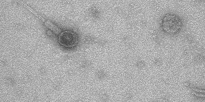 Бактериофаги - обитатели мочевого пузыря человека
