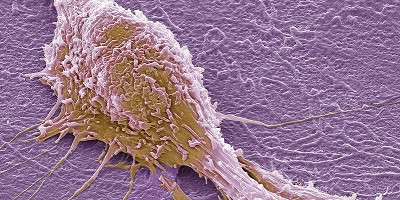 Бактериофаги испытают в лечении колоректального рака