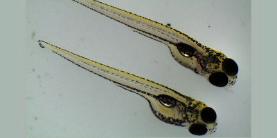 Фаги проти Pseudomonas aeruginosa при муковісцидозі