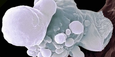 Синергізм між імунною системою та бактеріофагами при лікуванні гострих інфекцій дихальних шляхів
