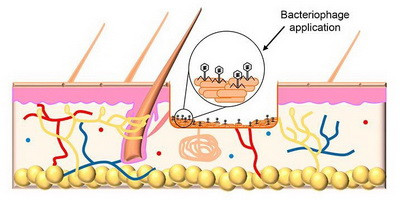 Бактеріофаги проти біоплівок при хронічних ранах