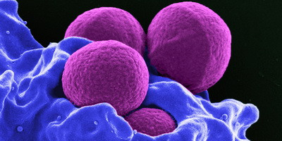 Більше мільйона смертей щорічно спричинені стійкістю бактерій до антибіотиків