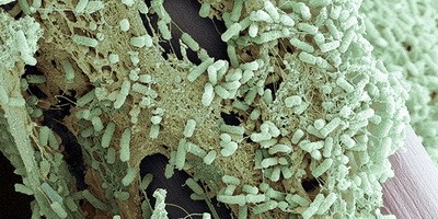 Бактерії, стійки до антибіотиків: п’ять викликів сучасній медицині