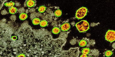 Бактериофаги и коронавирусная болезнь COVID-19