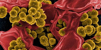 Безпечність внутрішньовенного введення бактеріофагів при стафілококовій інфекції
